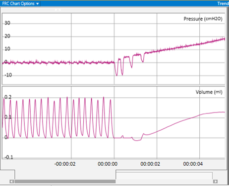 No Efforts During FRC Occlusion.png